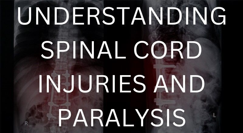 Understanding spinal cord injuries and paralysis